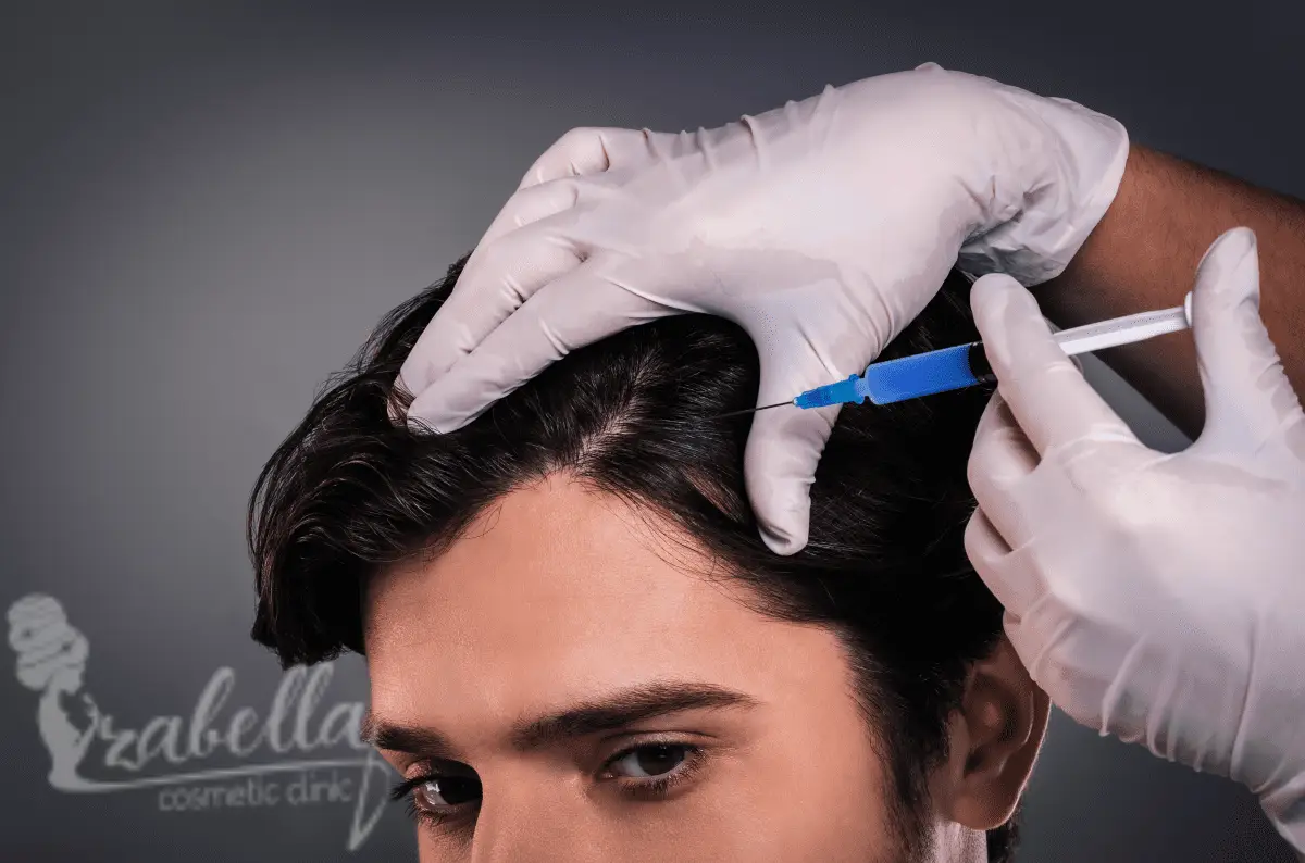 حقن الميزوثيرابي للشعر