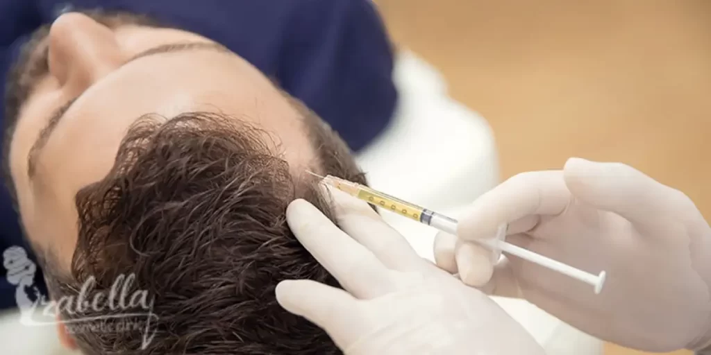 حقن الميزوثيرابي لعلاج تساقط الشعر
