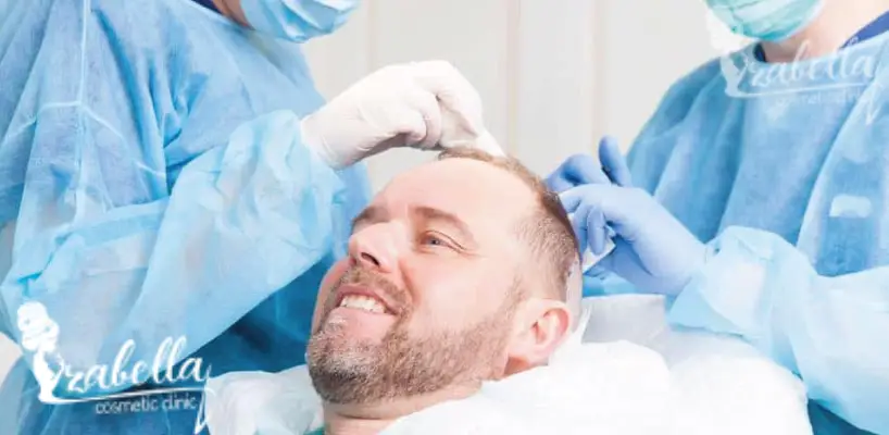 دكتور زراعة الشعر