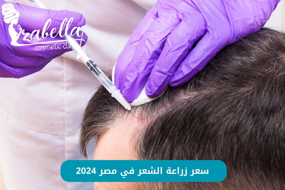 سعر زراعة الشعر في مصر 2024