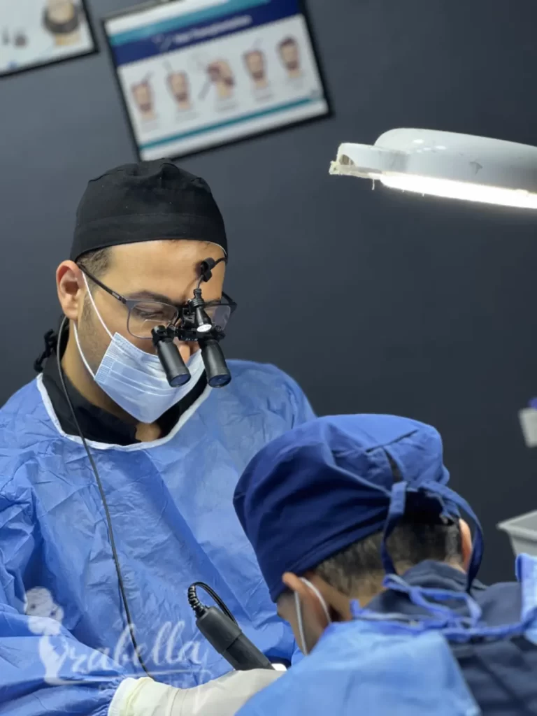 عيوب زراعة الشعر بالاقتطاف