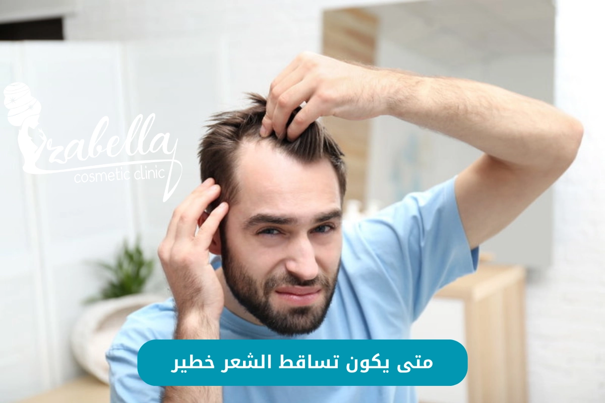 متى يكون تساقط الشعر خطير