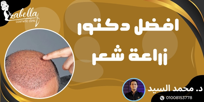 دكتور زراعة شعر