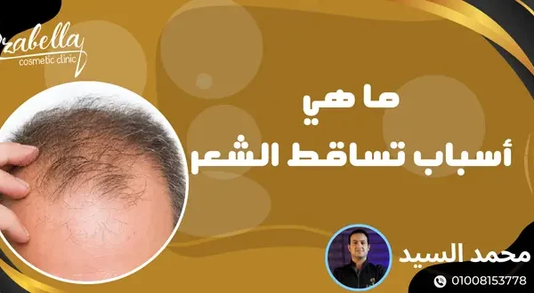اسباب تساقط الشعر