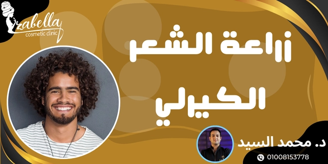 زراعة الشعر الكيرلي