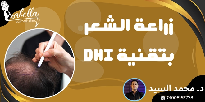 زراعة الشعر بتقنية dhi