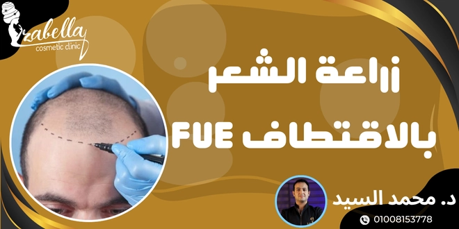 زراعة الشعر بالاقتطاف