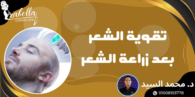 تقوية الشعر بعد زراعة الشعر