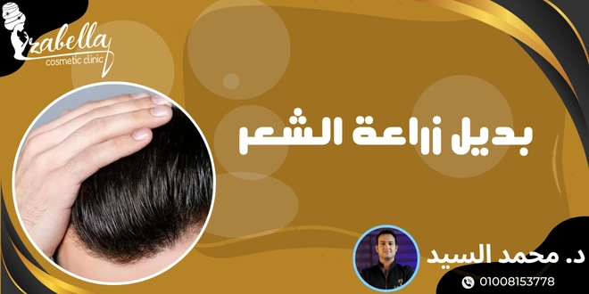 بدائل زراعة الشعر