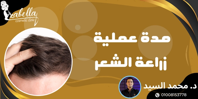 مدة عملية زراعة الشعر