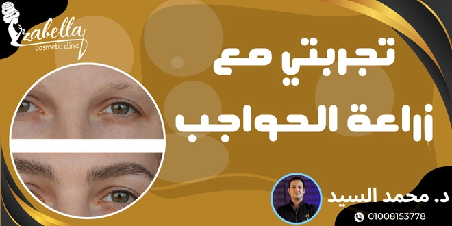 تجربتي مع زراعة الحواجب