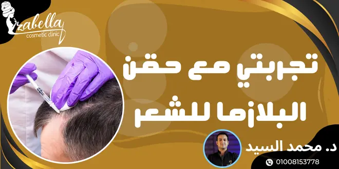 تجربتي مع حقن البلازما للشعر