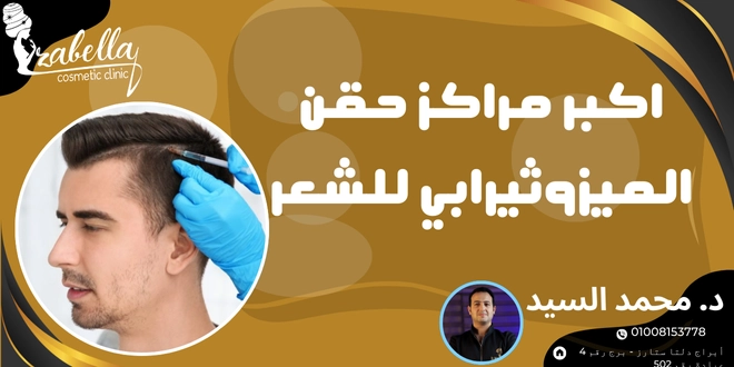 حقن الميزوثيرابي للشعر