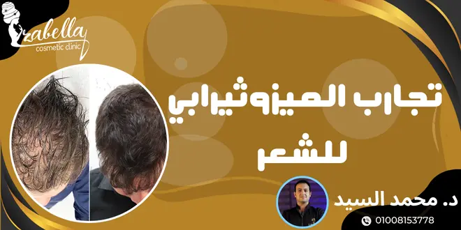 تجارب الميزوثيرابي للشعر