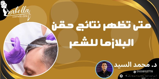 متي تظهر نتائج حقن البلازما للشعر