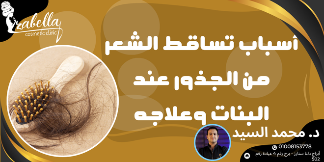 اسباب تساقط الشعر من الجذور عند البنات