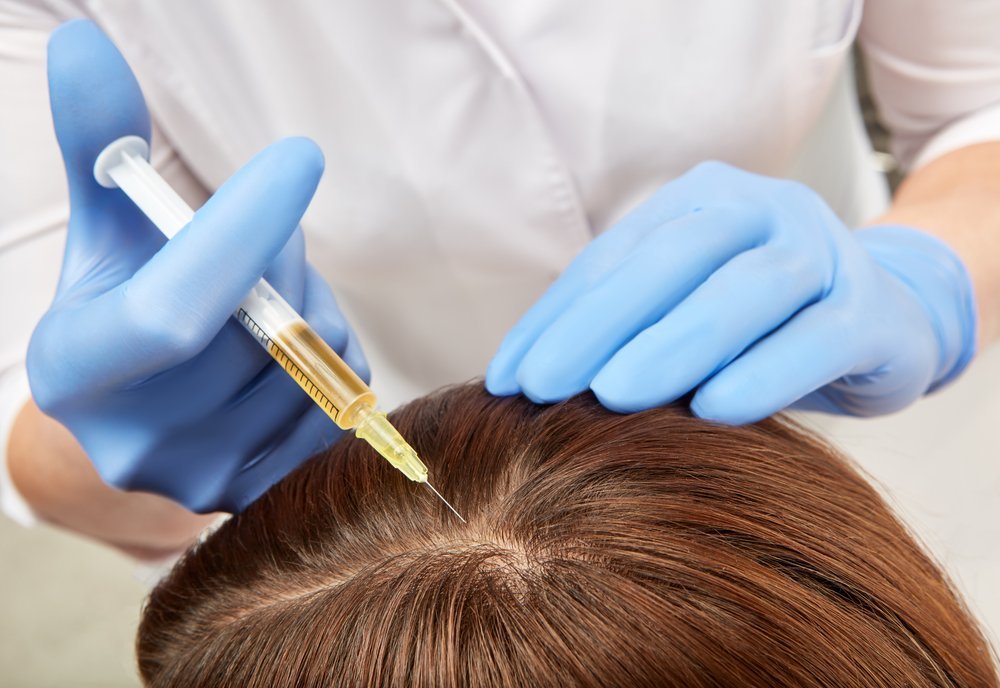 Hair plasma injections in Egypt
