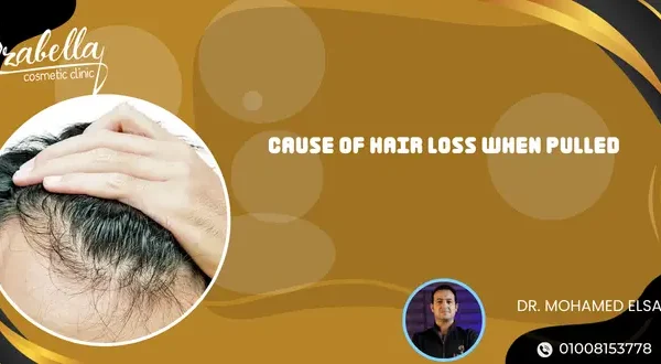 Cause of hair loss when pulled