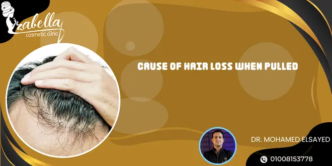 Cause of hair loss when pulled