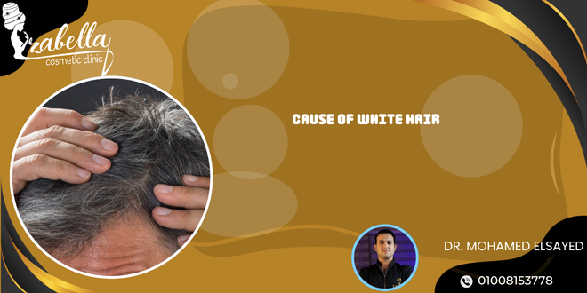 Cause of white hair