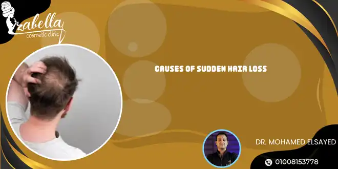 Causes of sudden hair loss
