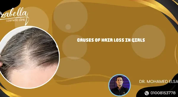 Causes of hair loss in girls