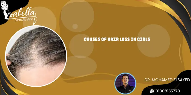 Causes of hair loss in girls