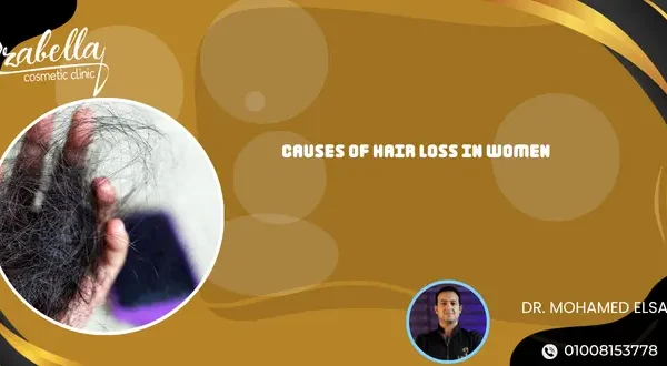 Causes of hair loss in women