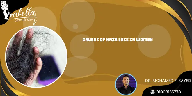 Causes of hair loss in women