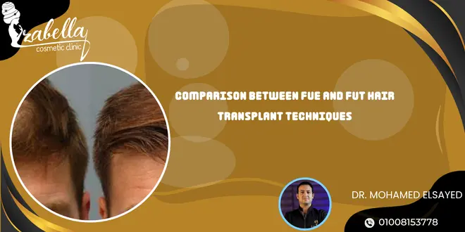 Comparison between FUE and FUT hair transplant techniques