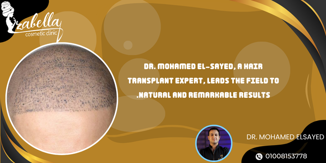 Dr. Mohamed El-Sayed, a hair transplant expert, leads the field to natural and remarkable results.