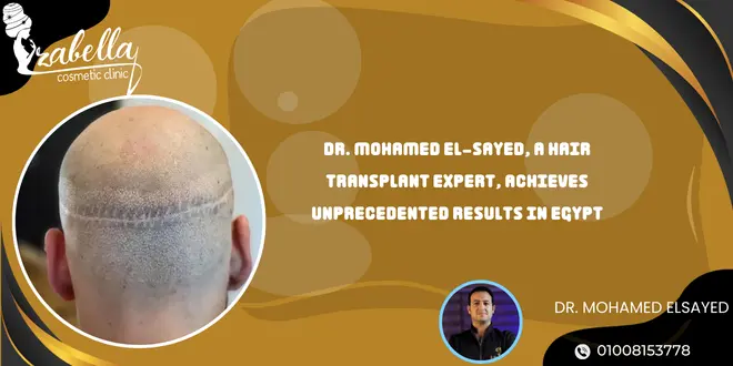 Dr. Mohamed El-Sayed, a hair transplant expert, achieves unprecedented results in Egypt