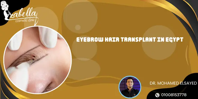 Eyebrow hair transplant in Egypt