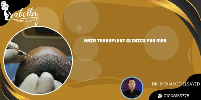 Hair Transplant Clinics for Men