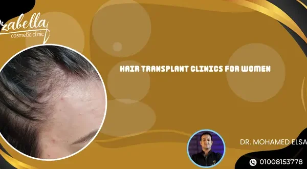 Hair Transplant Clinics for Women