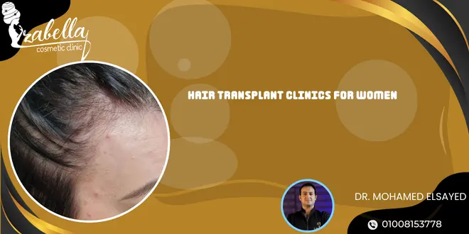 Hair Transplant Clinics for Women