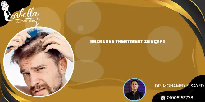 Hair loss treatment in Egypt