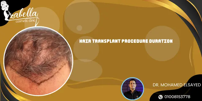 Hair transplant procedure duration