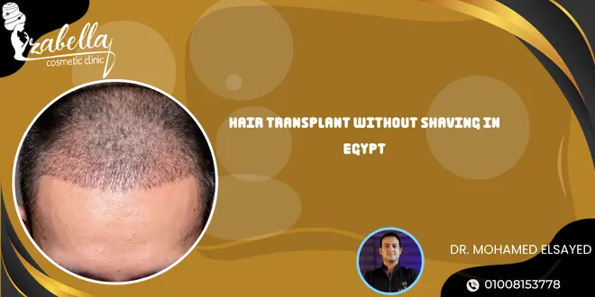 Hair transplant without shaving in Egypt