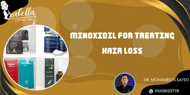 Minoxidil for treating hair loss