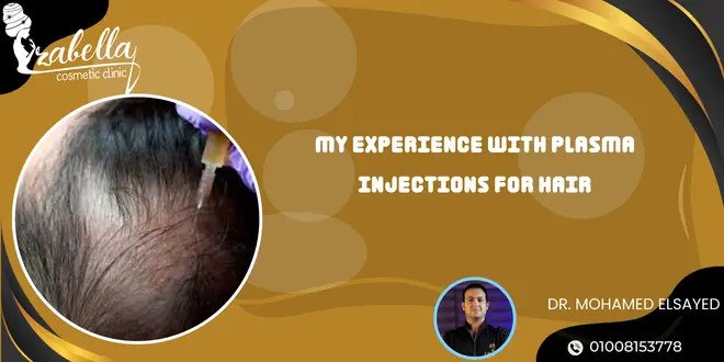 My experience with plasma injections for hair