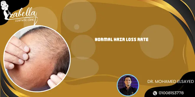 Normal hair loss rate
