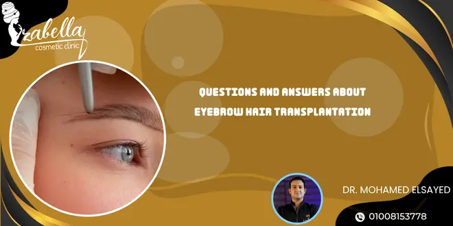 Questions and answers about eyebrow hair transplantation