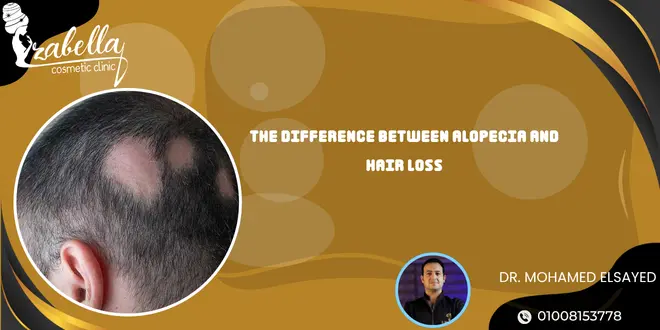 The difference between alopecia and hair loss