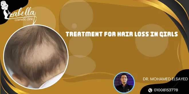 Treatment for hair loss in girls