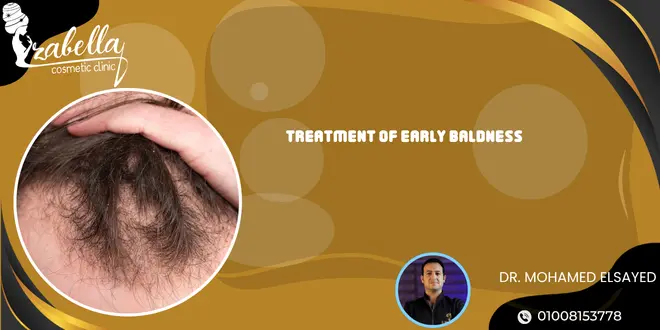Treatment of early baldness