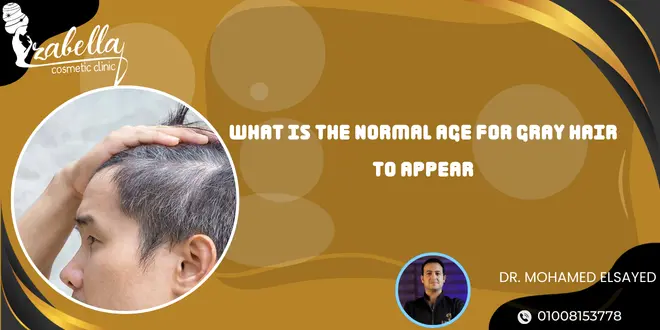 What is the normal age for gray hair to appear?