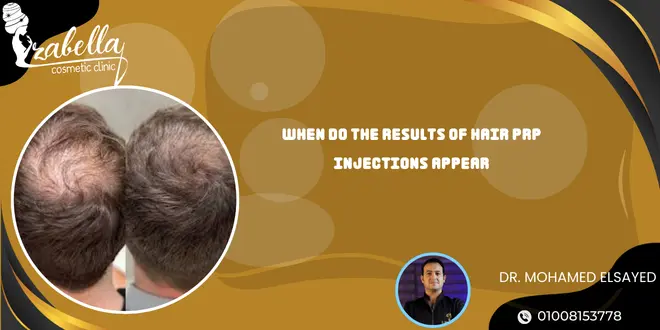 When do the results of hair PRP injections appear