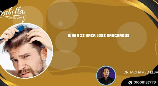When is hair loss dangerous