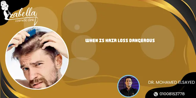 When is hair loss dangerous